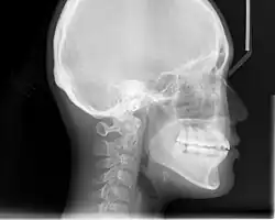 An X-ray taken for skull analysis