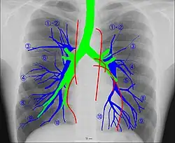 Human chest radiographic anatomy.