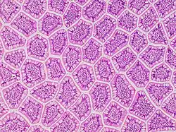 Cross-section histology of small intestinal villi of the human terminal ileum.