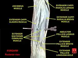 Extensor carpi ulnaris muscle