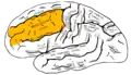 Lateral surface of left cerebral hemisphere.