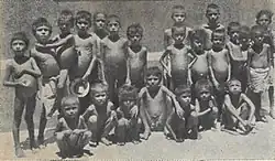 A group of 15 boys, 10 standing and five squatting. Most appear naked. All have prominent pot-bellies but ribs obviously showing, a common symptom of malnutrition.