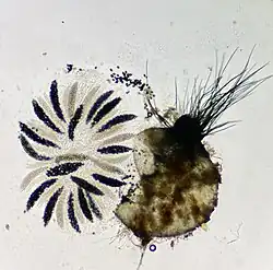 Phase-contrast micrograph of a Triangularia setosa perithecium with radiating asci