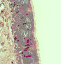 pseudostratified epithelium