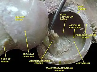 Hip joint. Lateral view. Femur head