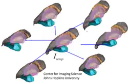 figure depicting multiple coordinate systems generated from MRI images and generating a common template coordinate system.