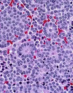 With prominent rosettes